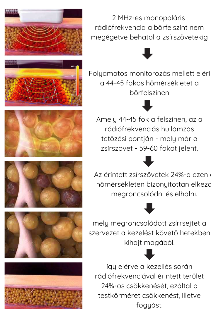 Monosculpt működési elv