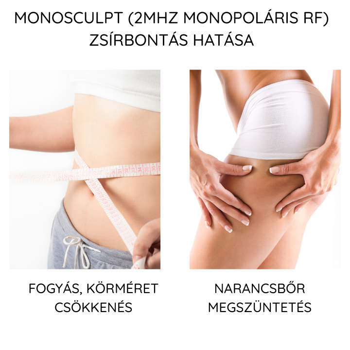 Monosculpt hatása